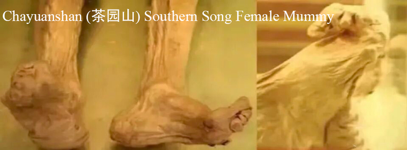 Valentino Pig-Trotter Shoes Echo Foot Binding Trauma